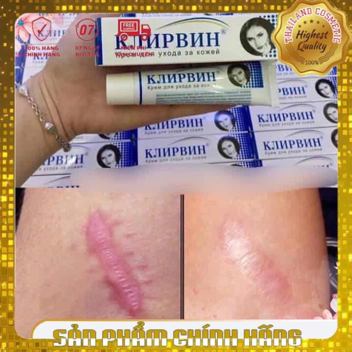 Kem hỗ trợ mờ sẹo mờ thâm, rạn da Klirvin Nga 25G