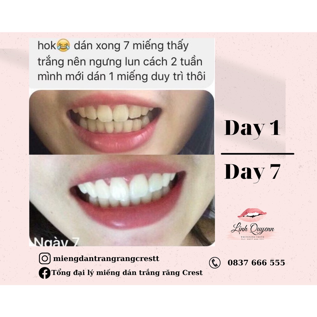 Miếng dán trắng răng Crest 3D Whitestrips Noticeably White -  FULLBOX 10 Gói