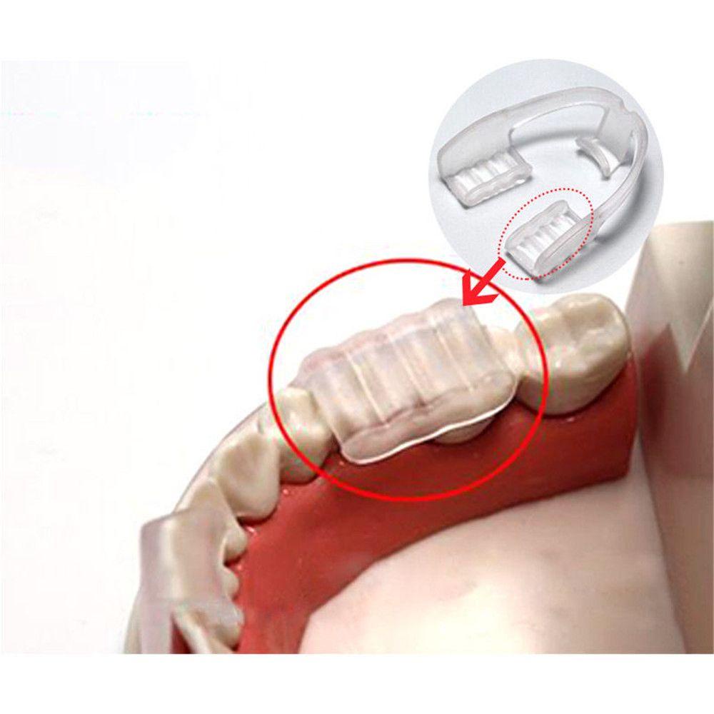Miếng Ngậm MALCOLM Bảo Vệ Miệng Khi Ngủ Thông Dụng