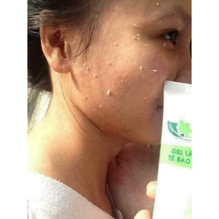 GEL LÀM SẠCH TẾ BÀO DA CHẾT