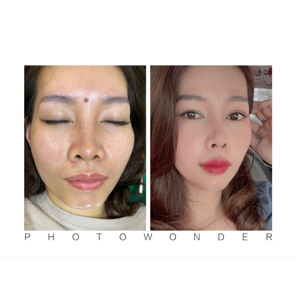 CHÍNH HÃNG GCOOP Mặt nạ gel nâng cơ xóa nhăn cấp tốc Lifting Gel Carecella
