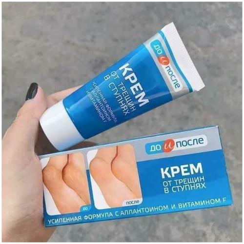 Kem bôi Nứt Gót Chân, Kem  Hồi Phục Nứt Nẻ Gót Chân Kpem Nga 50ml - Dưỡng Ẩm Và Làm Mềm Gót Chân Hiệu Quả