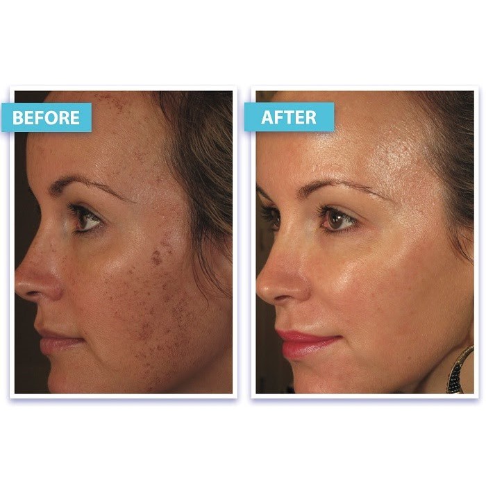 Kem Chống Lão Hóa, Phục Hồi và Trắng Sáng Da Image Ageless Total Repair Creme 50ml