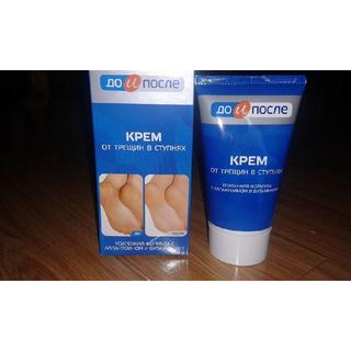 Kem trị nứt gót chân Nga Apteka