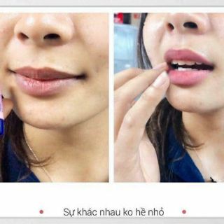 Son dưỡng mỡ hươu mini ASTRID