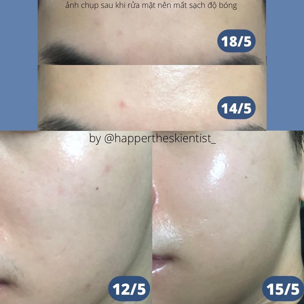 Serum phục hồi kháng khuẩn Demaquest Essential B5 Hydrating Serum