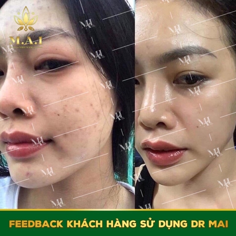 SERUM DR.MAI NGUYÊN CHẤT MIX SAFFARON