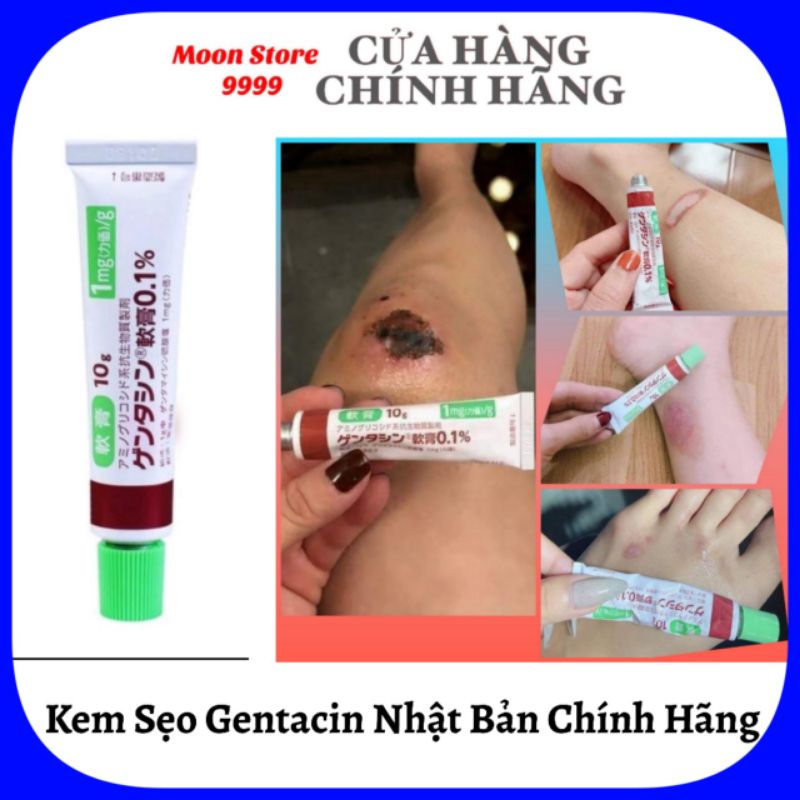 [Hỏa tốc HCM] Kem giảm mụn, giảm sẹo Gentacin tuýp 10g nội địa Nhật Bản