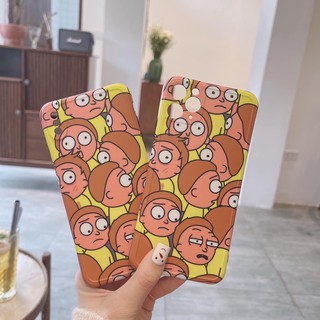 XẢ LỖ ỐP IMD CHỐNG BẨN