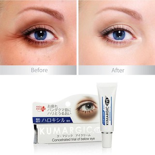 Kem Mờ Quầng Thâm Mắt Hadariki Kumargic Eye Cream Hang Nhat