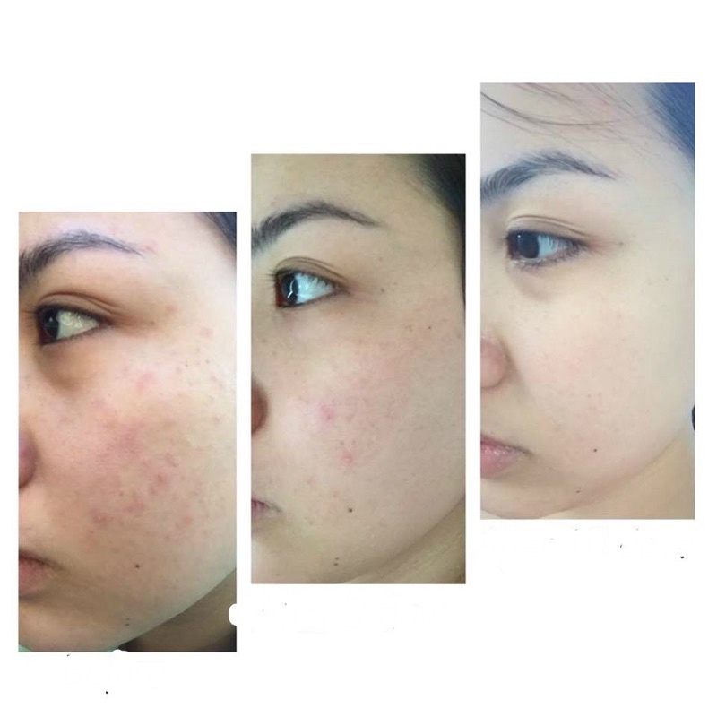 [HÀNG CÔNG TY] Kem dưỡng trẻ hoá da Retinol Ông Bà Già