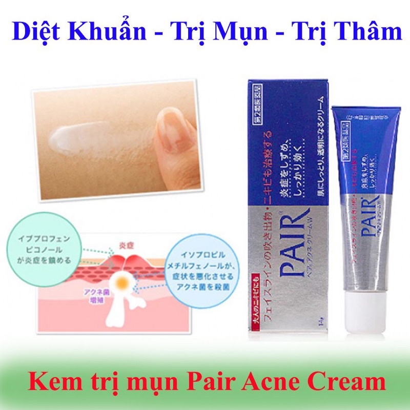 🎀 kem giúp giảm mụn #Pair dạng tuýp 24g số 1 Nhật 🇯🇵🎀 | BigBuy360 - bigbuy360.vn