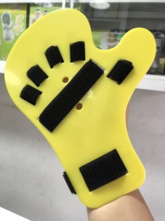 Nẹp cố định bàn tay