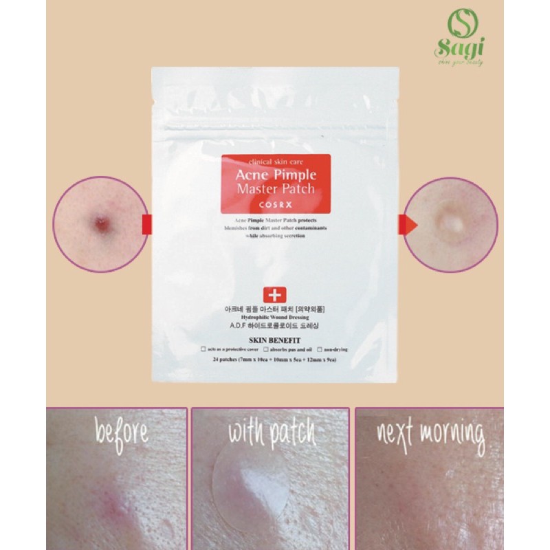 Miếng Dán Mụn Cosrx Acne Pimple Master Patch | BigBuy360 - bigbuy360.vn