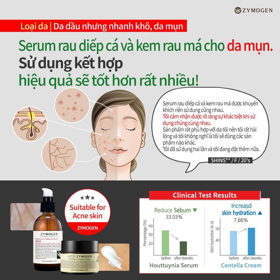 [HÀNG CÔNG TY] Kem rau má lên men Zymogen cho da mụn, treatment