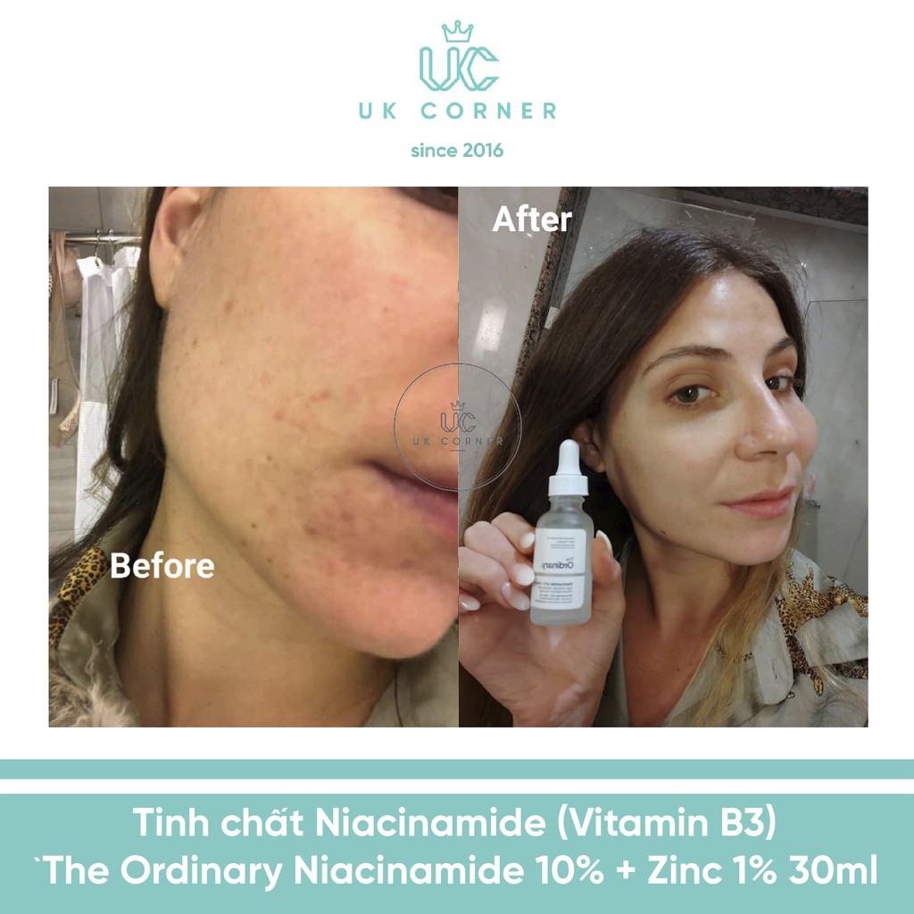 [Serum] Tinh chất Niacinamide (Vitamin B3) The Ordinary Niacinamide 10% + Zinc 1%