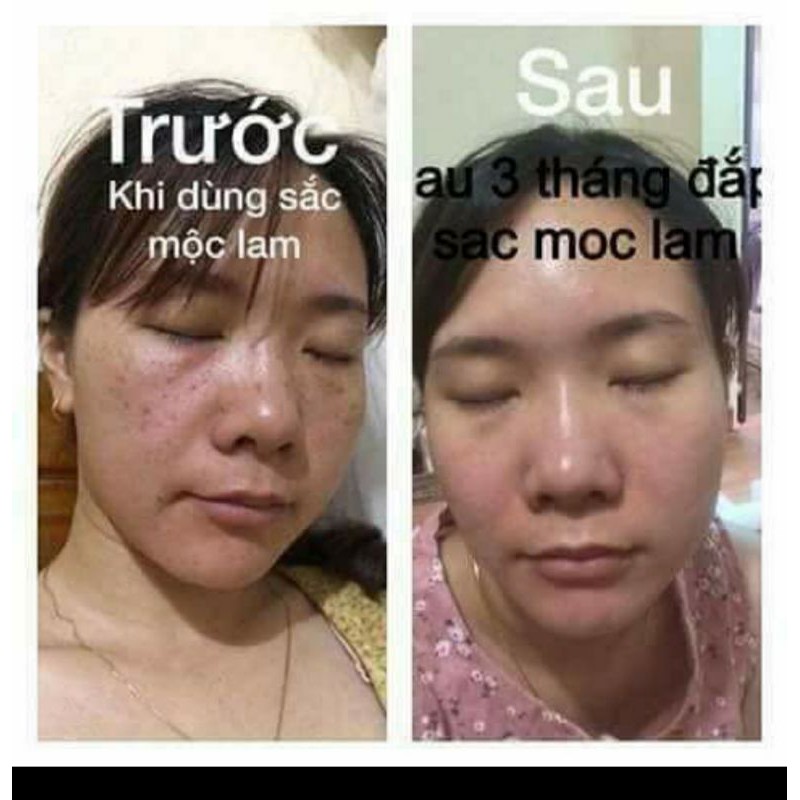 Sắc Mộc Lam (hàng chính hãng) 30ml