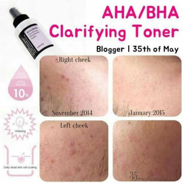 LLO Nước cân bằng đựng AHA/BHA Clarifying Treatment Toner Cosrx 79 2