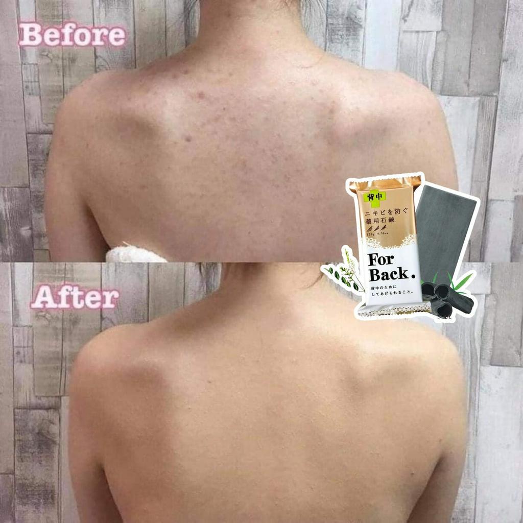 Xà Phòng Ngừa Mụn Lưng Pelican For Back 135gr
