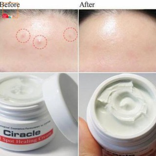 Kem Trị Mụn Ciracle Red Spot Healing Cream