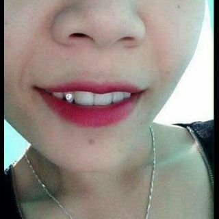 Đá đính răng, đá gắn răng