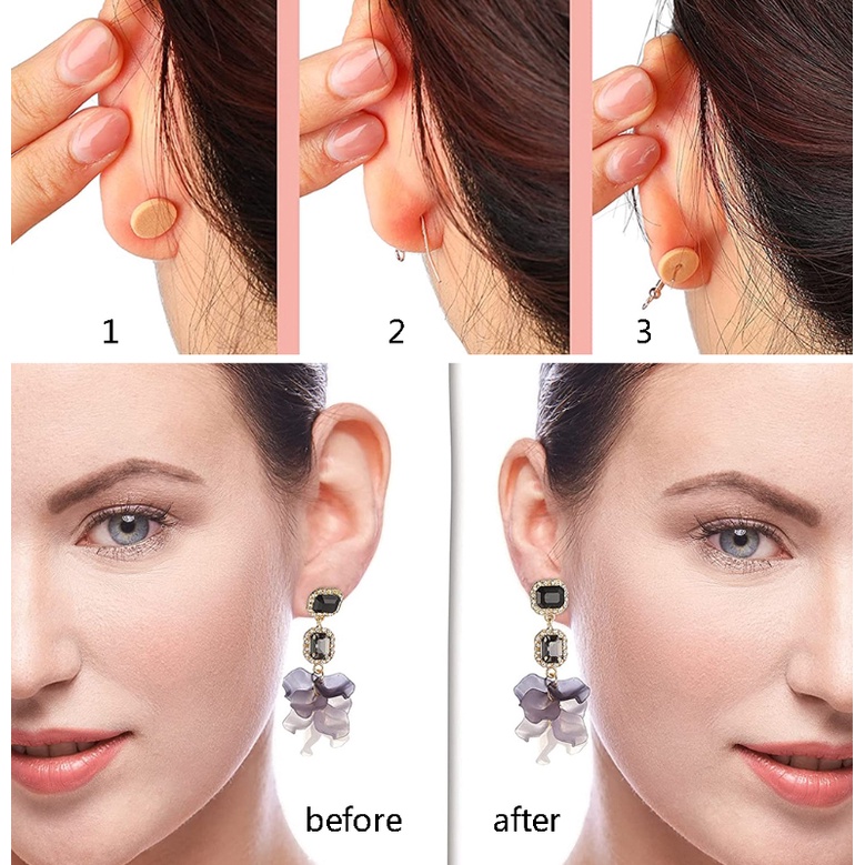 Set 300 Miếng Dán Hỗ Trợ Nâng Và Làm Giãn Lưng Bông Tai