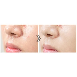 Nước Hoa Hồng Trị Mụn G9 Skin AC Solution Toner
