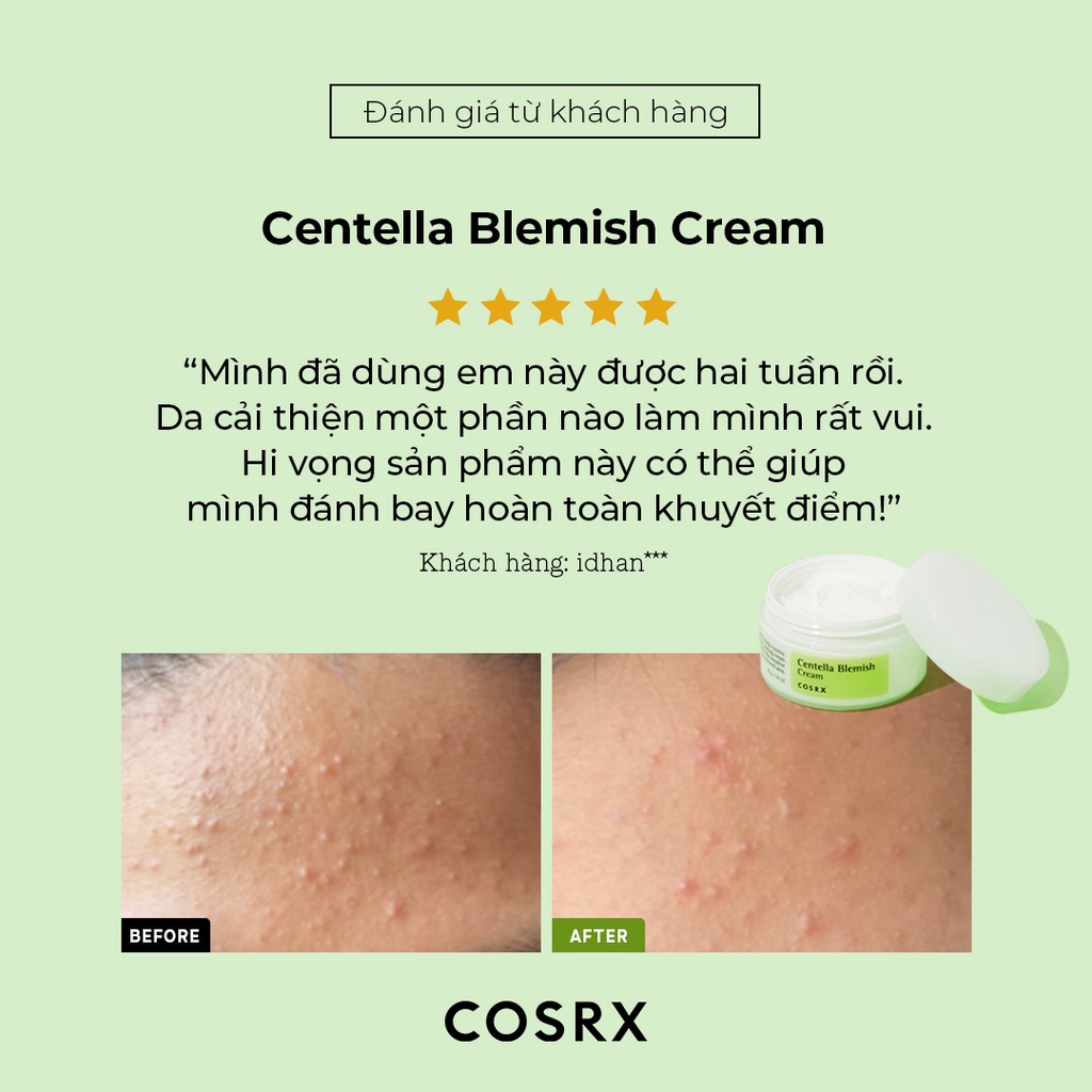 Kem dưỡng da cấp ẩm chiết xuất rau má COSRX Centella Blemish 30ml