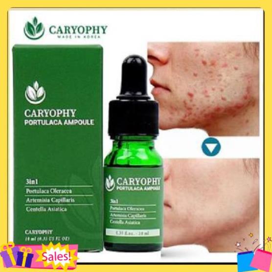Sỉ-  Serum ngăn ngừa mụn và thâm Caryophy Chính Hãng - Serum Mụn Ngăn Ngừa Mụn Ẩn,Mụn Đầu Đen | BigBuy360 - bigbuy360.vn