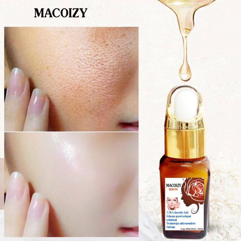 Bộ Serum Kem Xóa Sẹo Rỗ Sẹo Mụn Lâu Năm