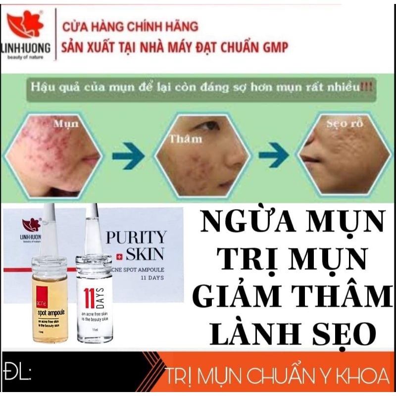 Ngăn Ngừa Mụn LinhHương | BigBuy360 - bigbuy360.vn