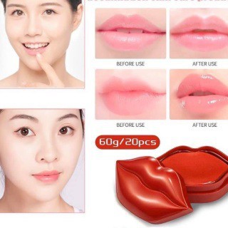 (Hàng Mới) Set 20 Mặt Nạ Môi Zuzo Chiết Xuất Cherry Dưỡng Ẩm Chống Khô Làm Sáng Màu Môi | BigBuy360 - bigbuy360.vn