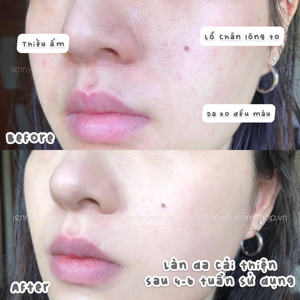 Kem Dưỡng Da Ngày &amp; Đêm Olay Total Effects 7 in 1 Moisturiser Nourish 50ml