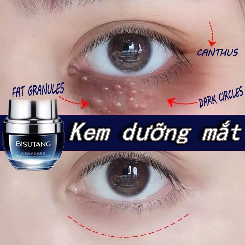 Kem trị thâm quầng mắt Kem dưỡng mắt quầng thâm Dưỡng ẩm vùng mắt 38g chăm sóc da serum eye cream