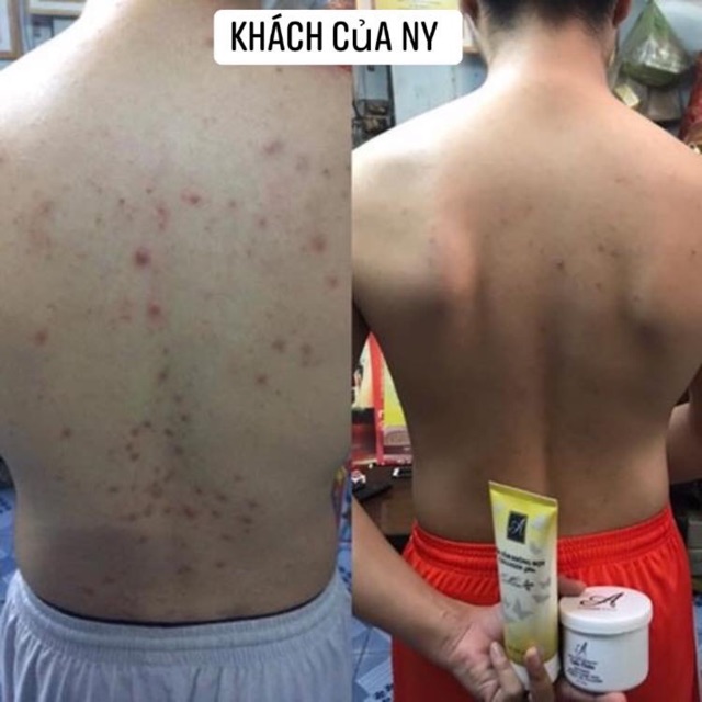 Muối Tẩy Da Chết hướng trá cây - 350g - Giúp làm sạch da và dưỡng da trắng sáng