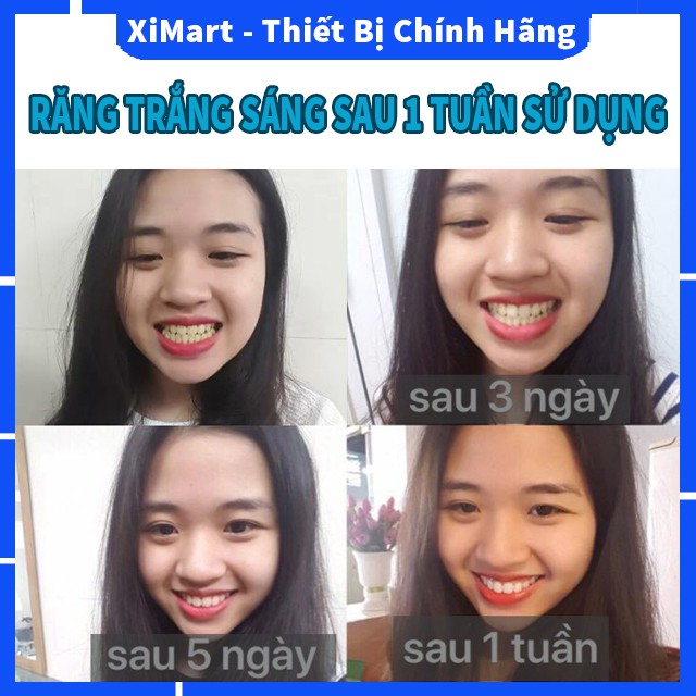 Máy làm trắng răng SMILEE tẩy trắng răng sau 7 ngày, không ê buốt, loại bỏ mảng bám, cao răng - XiMart