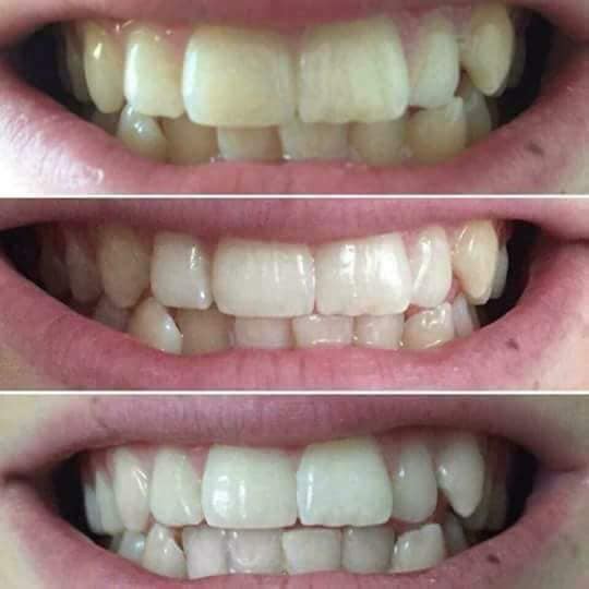 [Freesh] Kem đánh răng AP24 không lo ố vàng, không lo mảng bám răng - Kem đánh răng là sản phẩm chăm sóc răng miệng.