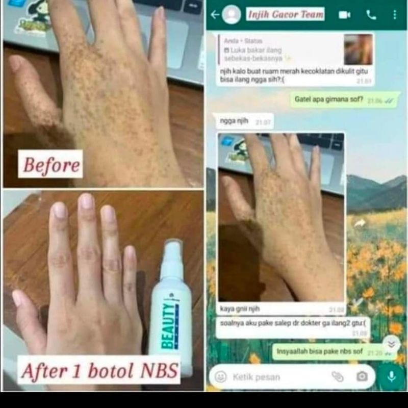 Xịt làm đẹp Natura | BigBuy360 - bigbuy360.vn