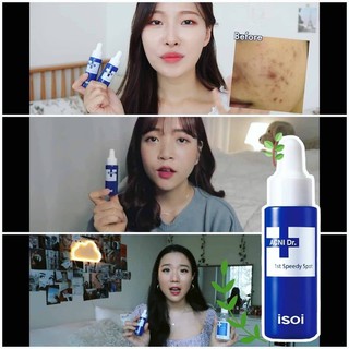 [SALE DATE T8/2025] Dòng sản phẩm dành  cho mụn ISOI