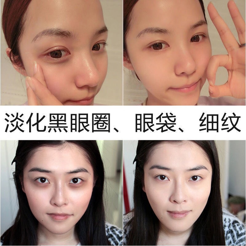 1 Tinh Chất Hexapeptide Dưỡng Ẩm Làm Sáng Xóa Quầng Thâm Và Bọng Mắt