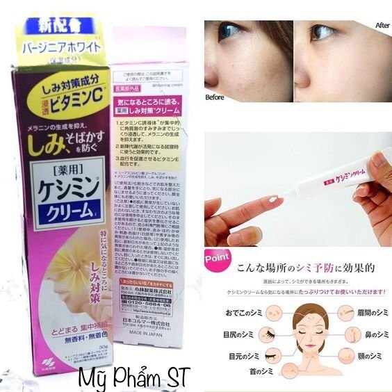 Kem loại bỏ nám tàn nhang kobayashi Nhật bản làm mờ nám tàn nhang đồi mồi dưỡng ẩm làm trắng da bảo vệ da khỏi tia UV