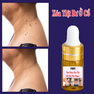 🌺Kem Xóa Nốt Ruồi