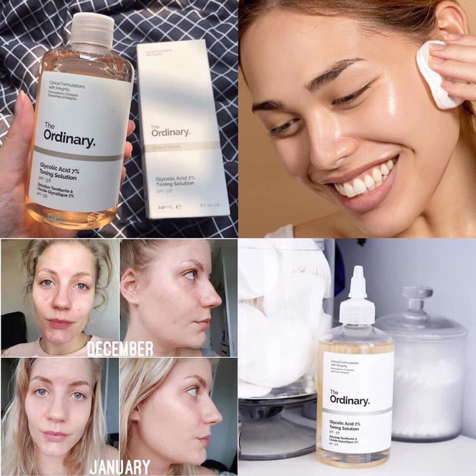 Toner Dưỡng Sáng Đều Màu Da The Ordinary Glycolic Acid 7% Toning Solution 240ml | BigBuy360 - bigbuy360.vn