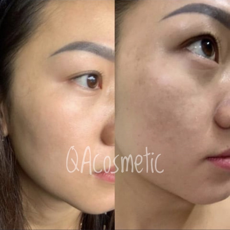 Kem Nám Mela Q Plus Cream giảm nám, trắng da, chống lão hóa 50ml Hàn Quốc