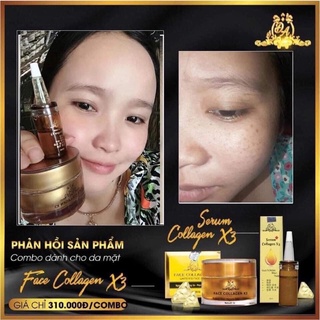 [Chính hãng] Serum Collagen X3
