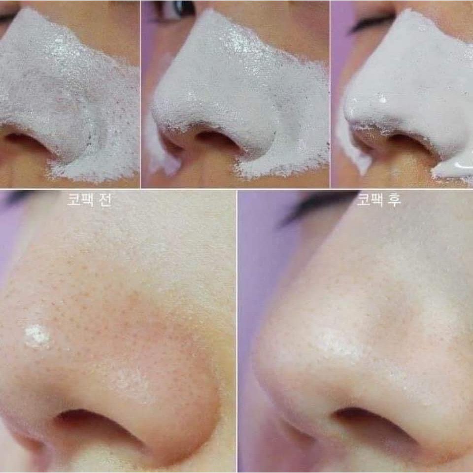 Gel Lột Mụn Đầu Đen - Mụn Cám Cao Cấp Tro Núi Lửa Jeju Volcanic TFS Hàn Quốc 50g