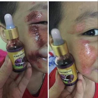 Tế bào thực vật siêu phục hồi da