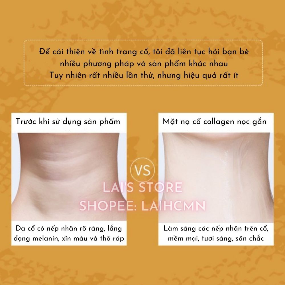 Hộp 10 Miếng Mặt Nạ Cổ Nọc Rắn QDQ Snake Venom Collagen Neck Membrane Dưỡng Ẩm, Trắng Sáng, Căng Mịn, Giảm Nếp Nhăn Ở Cổ