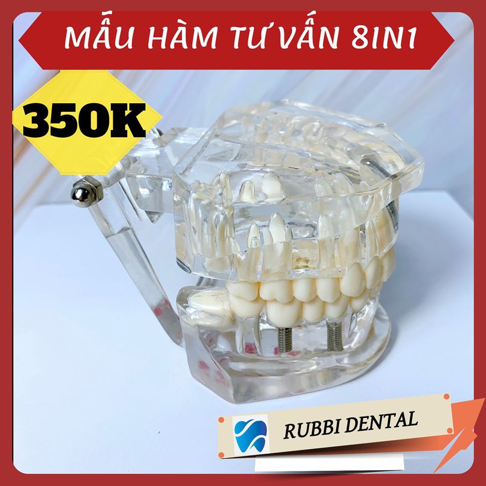 MẪU HÀM TƯ VẤN 8IN1 - ĐẦY ĐỦ CÁC BỆNH LÝ CẦN THIẾT TRONG NHA KHOA. PHÒNG KHÁM NÀO CŨNG CẦN CÓ. HÀNG CHUẨN