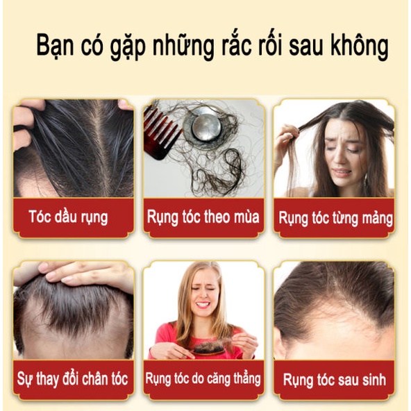 Dầu gội ngăn ngừa rụng tóc nam nữ dầu gội mọc tóc 500ml chống rụng tóc tăng độ dày cho tóc loai bỏ gàu giải quyết vấn đề